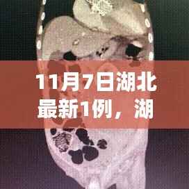 湖北新增病例解析与应对指南,从初学者到进阶用户的处理步骤解析(11月7日最新报告)