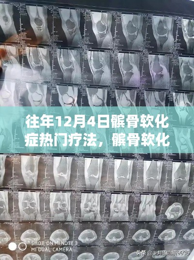 历年十二月四日髌骨软化症热门疗法回顾与历程梳理