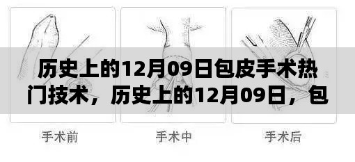 历史上的包皮手术革新里程碑,12月09日的手术技术革新回顾