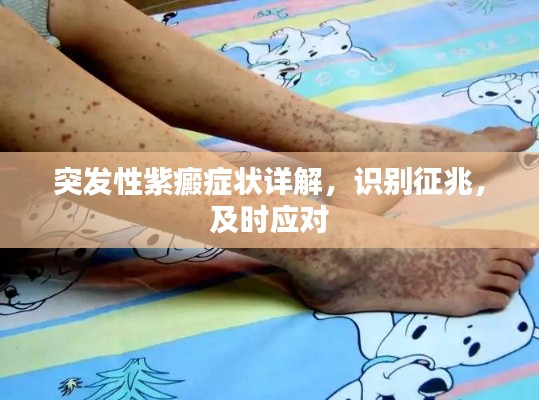 突发性紫癜症状详解,识别征兆,及时应对